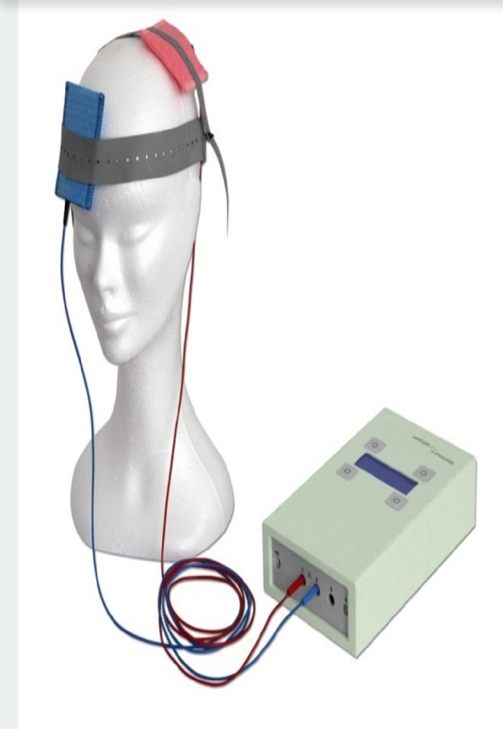 تحریک الکتریکی فراجمجمه ای مغز TDCS