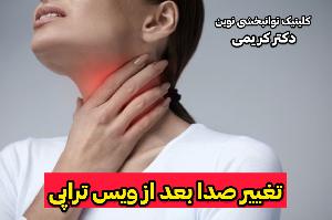 درمان گرفتگی صدا