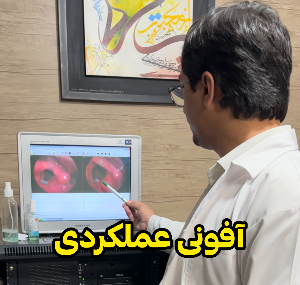 آشنایی با آفونی عملکردی
